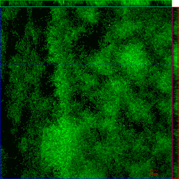 CLSM image of syto9 stained vibrio cholerae biofilm