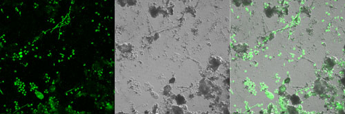 fluorescent and dic micrographs of the microbial community in the disturbed stream